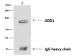 alpha Adducin Antibody in Immunoprecipitation (IP)