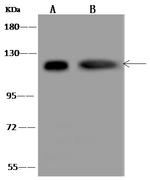 alpha Adducin Antibody in Western Blot (WB)