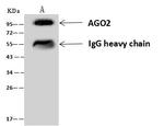 AGO2 Antibody in Immunoprecipitation (IP)