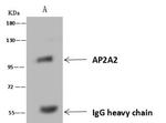 AP2A2 Antibody in Immunoprecipitation (IP)