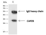 CAPZB Antibody in Immunoprecipitation (IP)