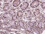 CHMP4A Antibody in Immunohistochemistry (Paraffin) (IHC (P))