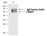CoA Synthase Antibody in Immunoprecipitation (IP)