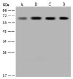 CoA Synthase Antibody in Western Blot (WB)