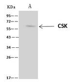 CSK Antibody in Immunoprecipitation (IP)