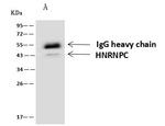 hnRNP C Antibody in Immunoprecipitation (IP)