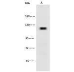 Leptin Receptor Antibody in Western Blot (WB)