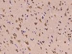 LIAS Antibody in Immunohistochemistry (Paraffin) (IHC (P))