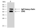 LIAS Antibody in Immunoprecipitation (IP)