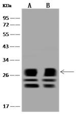 MTHFS Antibody in Western Blot (WB)