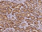 NDUFS6 Antibody in Immunohistochemistry (Paraffin) (IHC (P))