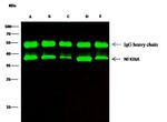 IkB alpha Antibody in Immunoprecipitation (IP)