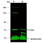 PAK1 Antibody in Immunoprecipitation (IP)