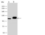 PDE4D Antibody in Western Blot (WB)