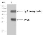 PIGX Antibody in Immunoprecipitation (IP)