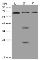 PNK Antibody in Western Blot (WB)