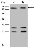 POLR3E Antibody in Western Blot (WB)