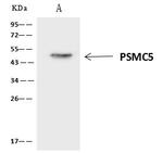 PSMC5 Antibody in Immunoprecipitation (IP)