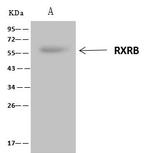 RXRB Antibody in Immunoprecipitation (IP)