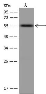 RXRB Antibody in Western Blot (WB)