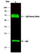 Sorcin Antibody in Immunoprecipitation (IP)