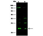 Sorcin Antibody in Western Blot (WB)