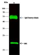 Sorcin Antibody in Immunoprecipitation (IP)