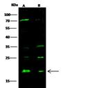 Sorcin Antibody in Western Blot (WB)