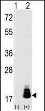 4EBP1 Antibody in Western Blot (WB)