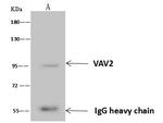 VAV2 Antibody in Immunoprecipitation (IP)
