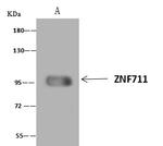 ZNF711 Antibody in Immunoprecipitation (IP)