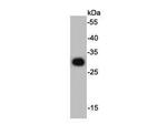 HSV tag Antibody in Western Blot (WB)