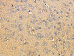 Phospho-RIP2 (Ser176) Antibody in Immunohistochemistry (Paraffin) (IHC (P))