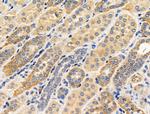 Phospho-RIP2 (Ser176) Antibody in Immunohistochemistry (Paraffin) (IHC (P))