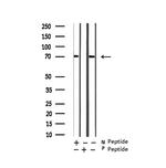 Phospho-RIP2 (Ser176) Antibody in Western Blot (WB)