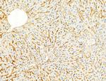 Phospho-ROCK2 (Tyr722) Antibody in Immunohistochemistry (Paraffin) (IHC (P))