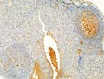 Phospho-ROCK2 (Tyr722) Antibody in Immunohistochemistry (Paraffin) (IHC (P))