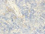 Phospho-ROCK2 (Tyr722) Antibody in Immunohistochemistry (Paraffin) (IHC (P))