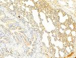 Phospho-ROCK2 (Tyr722) Antibody in Immunohistochemistry (Paraffin) (IHC (P))