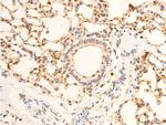 Phospho-EIF2S1 (Ser51) Antibody in Immunohistochemistry (Paraffin) (IHC (P))