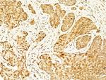 Phospho-JNK1/JNK2/JNK3 (Thr183, Tyr185) Antibody in Immunohistochemistry (Paraffin) (IHC (P))