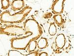 Phospho-JNK1/JNK2/JNK3 (Thr183, Tyr185) Antibody in Immunohistochemistry (Paraffin) (IHC (P))