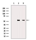 MMP8 Antibody in Western Blot (WB)