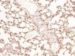 Phospho-BRCA1 (Ser1497) Antibody in Immunohistochemistry (Paraffin) (IHC (P))