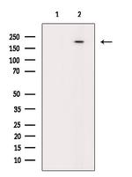 Phospho-BRCA1 (Ser1497) Antibody in Western Blot (WB)
