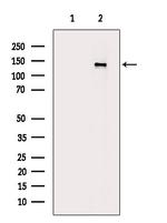 Phospho-PDGFRA (Tyr1018) Antibody in Western Blot (WB)