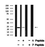 Phospho-NACA (Ser43) Antibody in Western Blot (WB)