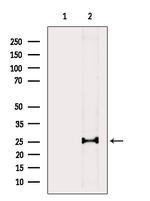 Phospho-NACA (Thr159) Antibody in Western Blot (WB)