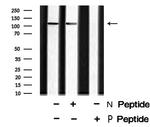 Phospho-EphA2 (Tyr930) Antibody in Western Blot (WB)