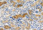 NKCC1 Antibody in Immunohistochemistry (Paraffin) (IHC (P))